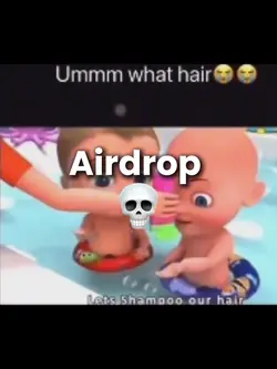 What hair? 😭 