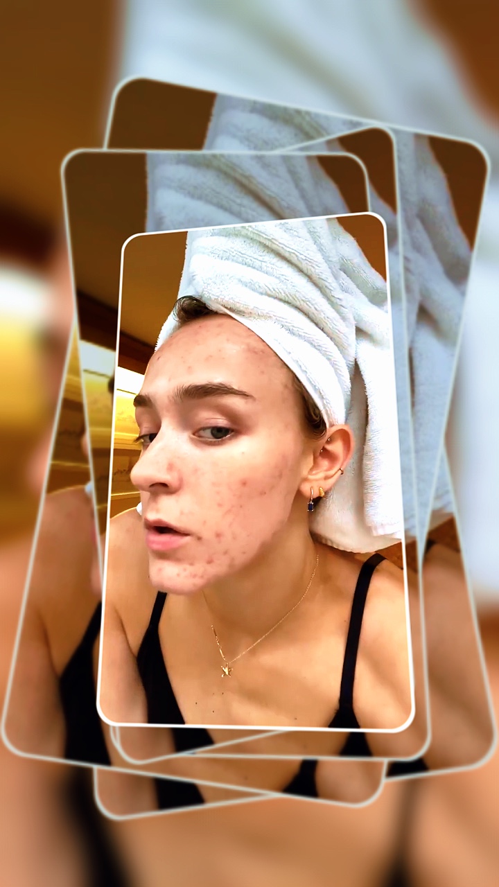 Skin care