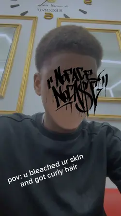 u bleached ur skin
