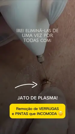 Jato de Plasma