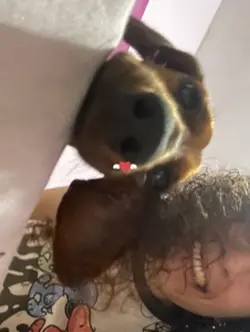 mi marcapasos <3