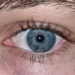 eye pic