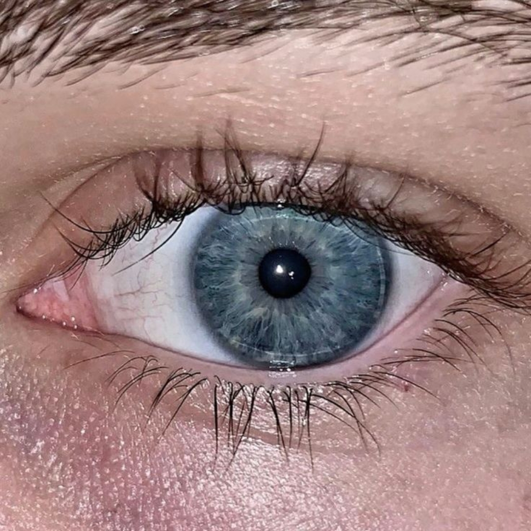 eye pic