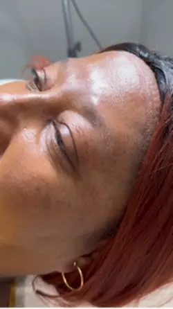 Brows