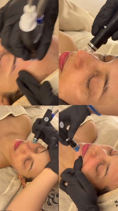 Facial