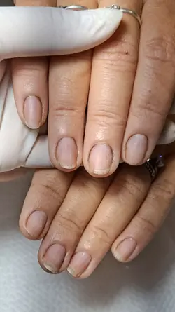 antesdepois unhas.