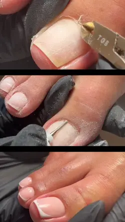 pedicure