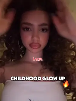 Childhood glow up🔥