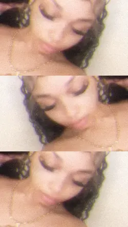 triple split’