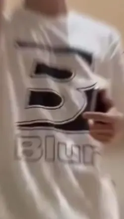 슈아 얼굴 무슨일…