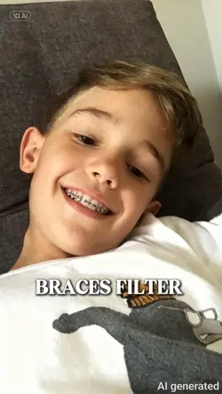 BRACES FILTER