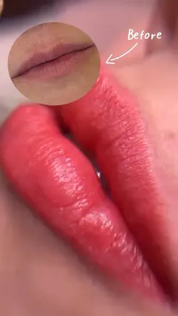 Micropigmentação 