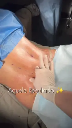 Cirurgia Plástica 