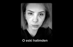 O Eski Halimden Eser