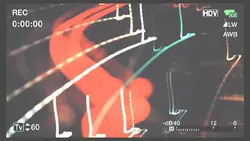 Trend vlog