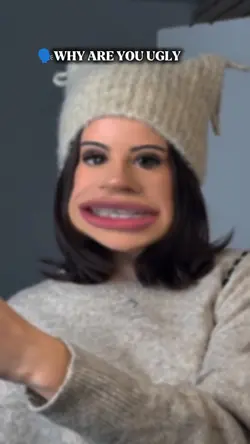 Why are you ugly 