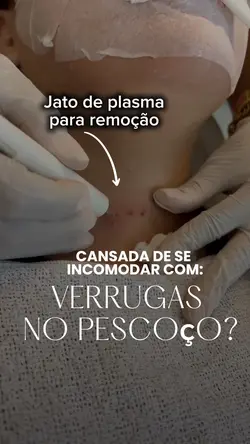Estética CORPORAL