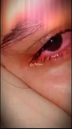 crying eyes 