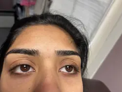 lash lifting