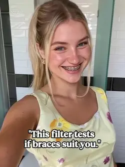 braces ai filter