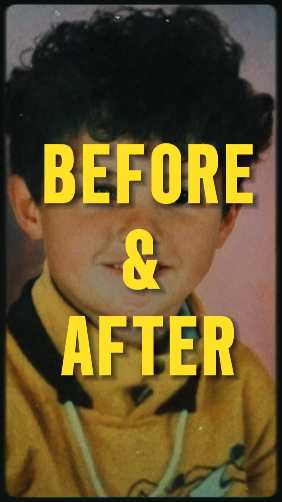 BEFORE & AFTER 