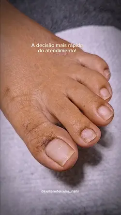 Pedicure 