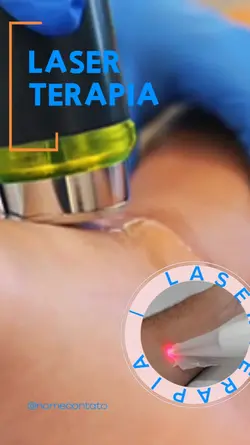 LASERTERAPIA LASER