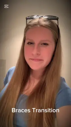 Braces 