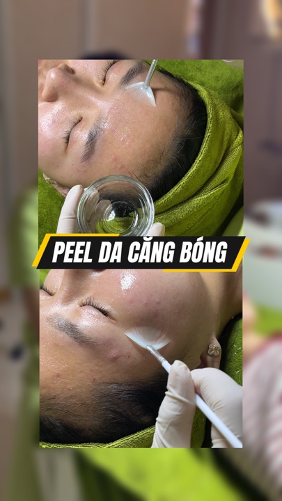 Peel da