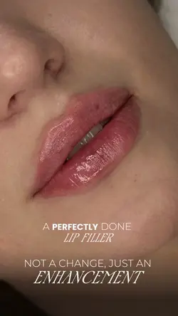 Aesthetic LIP