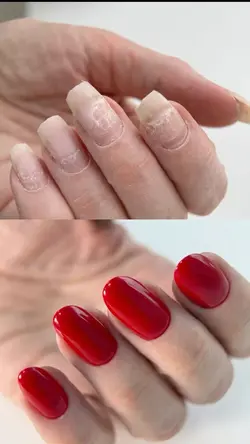 Antes x depois 