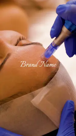 Microneedling aesthe