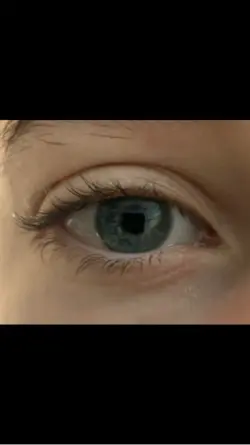 Eye Colour