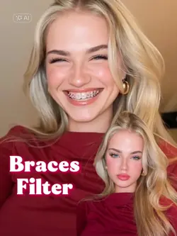 Braces Ai