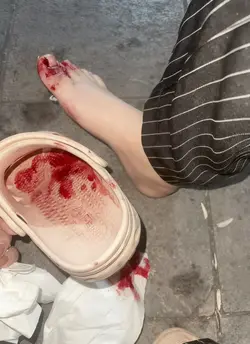 prank effect injury