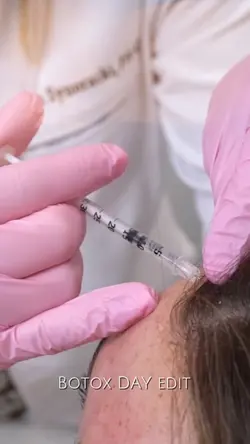 Botox treatment
