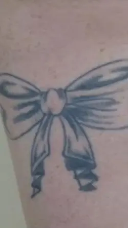 Laser tattoo