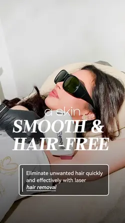 Hair removal laser