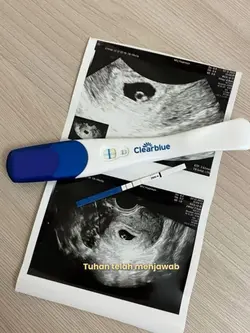 Tuhan telah menjawab