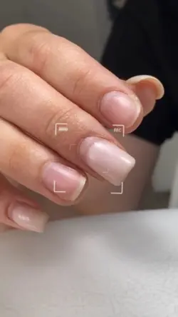 Antes e depois nail 