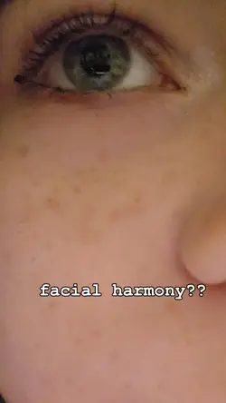 facial harmony?