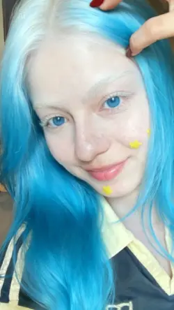 albino blue hair 