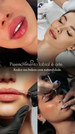 lábios estética