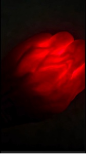 Explosion