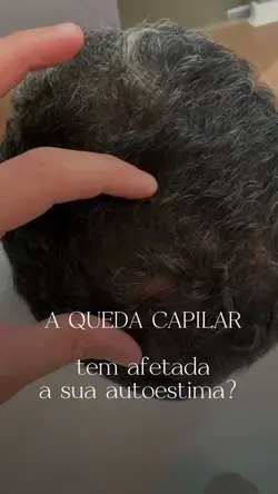 Queda CAPILAR