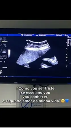 Segundo amor 