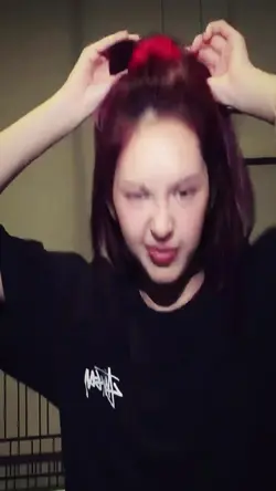 Epic transition