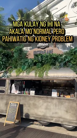 Kulay nang ihi