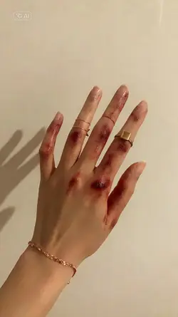 Ai Wounds
