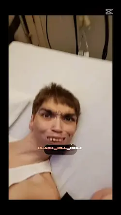 black pill